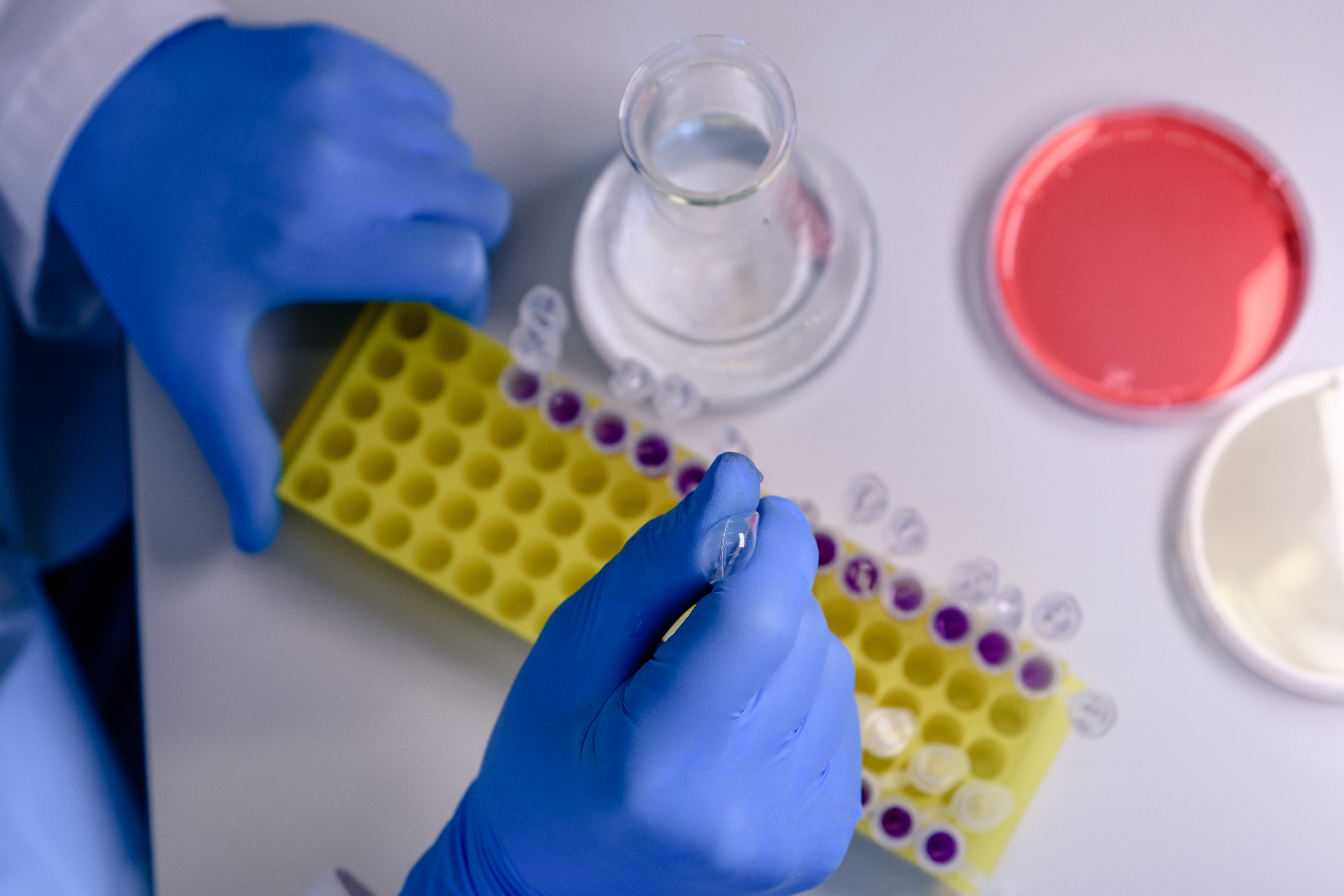 Consommables de laboratoire : tubes de prélèvement, collecteurs d’aiguilles, flacons